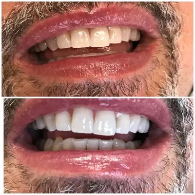 29644 healthy teeth and gums