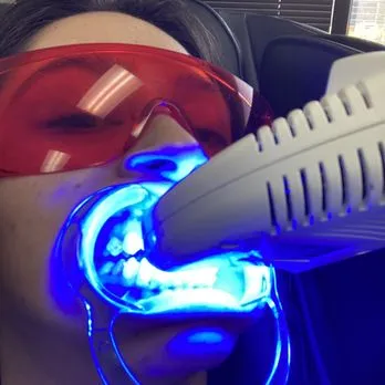 29644 teeth whitening cost