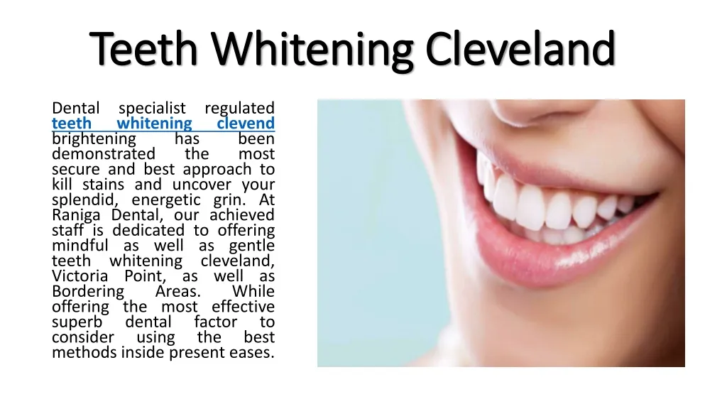 29647 cleveland teeth whitening in office