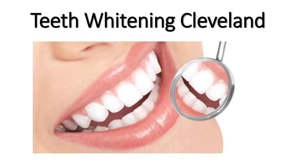 29647 cleveland teeth whitening options